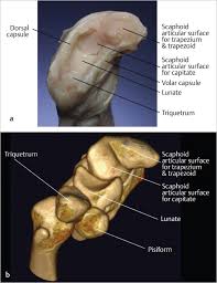 Maybe you would like to learn more about one of these? 38 Imaging And Anatomy Musculoskeletal Key