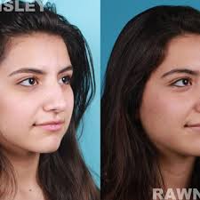 JEFFREY RAWNSLEY, MD