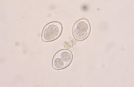 Coccidia of the genus isospora in cats, dogs and man. Coccidiosis In Cats Vca Animal Hospital