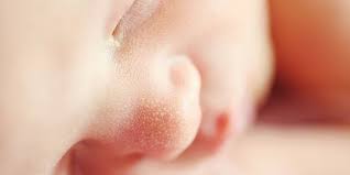 Penyakit kuning bisa menjangkit bayi baru lahir maupun orang dewasa, karenanya penting mengetahui gejala awal penyakit ini supaya penyebabnya bisa diatasi. Ciri Bayi Kuning Baru Lahir Ketahui Penyebab Dan Cara Menanganinya Semua Halaman Merdeka Com