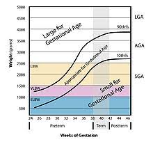 Large For Gestational Age Wikipedia