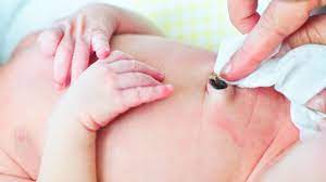 He had at least five or six baths before his cord fell off on day 15. Umbilical And Baby Belly Button Care Raising Children Network