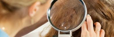 Apply baby oil to the scalp. Lice Can T Jump 10 Myths About Head Lice Debunked Lice