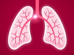 It is due to a blockage in a blood vessel in the lungs. Postoperative Pulmonary Embolism Rate Is High Among Cancer Free Middle Aged Patients Docwire News