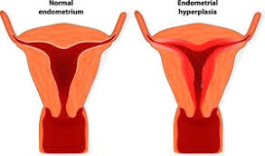 You should be aware of the possible symptoms of cervical cancer or uterine cancer such as change in urinary habits, skin ulcers, and hemorrhages. 10 Warning Signs That Save Women From Endometrial Cancer Sass101