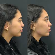 Debora Engel Clínica Estética