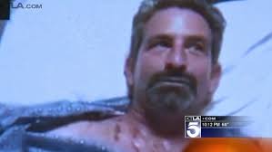 Man attacked by a bear in San Gabriel Mountains lucky to be alive