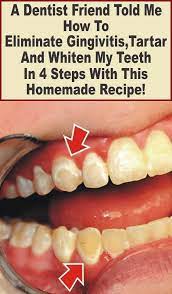 Pin On Health