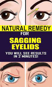 Common Remedy For Sagging Eyelids You Will See Results In 2 Minutes Remedies Drooping Eyelids Natural Acne Remedies Natural Remedies For Uti