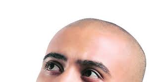 In men, hair often begins to recede. Why Are Men In Their Early 30s Losing Hair Lifestyle News The Indian Express