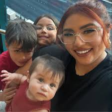 Splinter hemorrhage in thumb nail, possibly dog hair