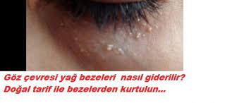 Yuzdeki Yag Bezelerinden Nasil Kurtulursunuz Yuzdeki Yag Bezelerinden Nasil Kurtulursunuz Yuzdeki Yag Bezelerinden Nasil Kurtulursun Mila Adi Veri Diy And Crafts