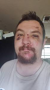 Can Yankees recover from current situation?