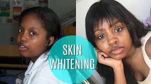 Korean Skin Whitening On Dark Skin Youtube