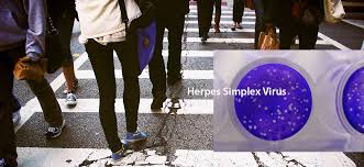774,097 likes · 8,618 talking about this. Massive Proportion Of World S Population Are Living With Herpes Infection