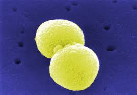 A basic working definition for a cluster of legionnaires' disease cases is essentially multiple cases that may be linked in space and time. Pneumokokken Wikipedia