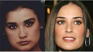 Demi Moore : Les chirurgies esthétiques qu'elle a subi