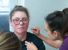 Watch The Bad Skin Clinic