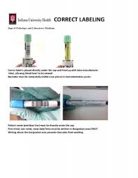 Tube Labeling Chart Iu Health