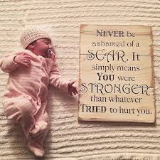 Never Be Afraid Of A Scar It Simply Means You Were Stronger Than Whatever Tried To Hurt You Such An Enco Really Good Quotes Vinyl Projects Hobbies And Crafts