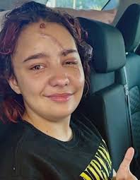 Tire rim flies through mother's windshield, severely injuring her  14-year-old daughter >>> https://tinyurl.com/46h9vfuk