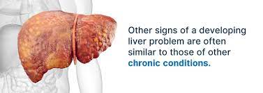Medical Marijuana For Liver Disease Marijuana Doctors