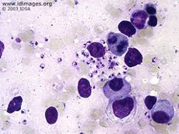 Leishmania Donovani Hematology Microbiology Lab Pathology Study