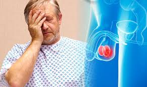 A feeling of heaviness in the scrotum. Testicular Cancer Symptoms Discovering A Lump Is The Biggest Indicator Of The Disease Express Co Uk