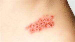 Maybe you would like to learn more about one of these? Ù„ÙŠØ³ Ù…Ù† Ø§Ù„Ù…Ø£Ù„ÙˆÙ Ø«Ø§Ù†ÙˆÙŠ ØªØ­ØµÙŠÙ„ Ø§Ù„Ø¶Ø±Ø§Ø¦Ø¨ Ø§Ø³Ø¨Ø§Ø¨ Ù…Ø±Ø¶ Ø§Ù„Ø­Ø²Ø§Ù… Ø§Ù„Ù†Ø§Ø±ÙŠ Allseasonsoutdoorkitchens Com