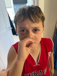 From itchy swollen eyes to living his best life yesterday! ❤️