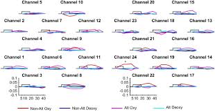 Listeners are presented with highly compressed speech. Adult Like Processing Of Time Compressed Speech By Newborns A Nirs Study Sciencedirect