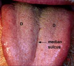 We did not find results for: Dorsum Median Sulcus Of Tongue