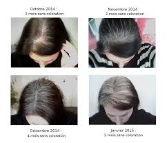 Si vous souhaitez retrouver votre chevelure d'antan, d'une couleur éclatante de vitalité et dénuée de cheveux blancs… la coloration végétale s'impose comme la solution idéale ! La Bicolorite Des Lectrices 12 50 Nuances De Gris Ou Comment J Ai Arrete De Me Teindre Les Cheveux