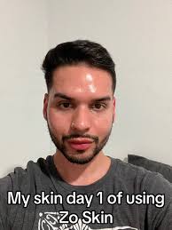 Zo Skin Health Brightalive Before and After