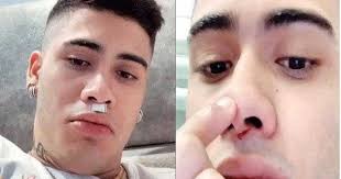 Especialista explica porque os dois procedimentos não devem ser feitos juntos e qual deve vir primeiro. Mc Kevinho E Hospitalizado Apos Ser Atingido No Rosto Por Placa De Pvc Antenados 2019