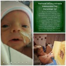 In honor of liver awareness month, here are ways to show your liver some  love!😍