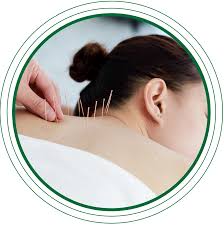 Acupuncture & Herbal Remedies