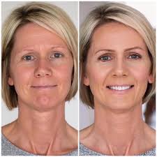 Showing support for Sadie with gold and purple