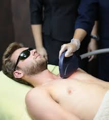ipl permanent hair removal for men in