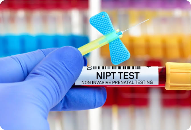 NIPT Test