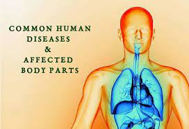 Out of total 78 organs of the body, at least 10 to 15 human body organs are major by size and function, know what are the largest organs (educational purposes). Common Human Disease Affected Body Parts Psc Arivukal