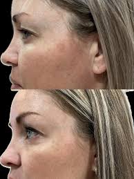 huronmedicalaestheticsclinic‎