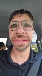 Couple Viral That Makes Duck Face