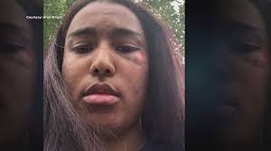 KARE 11 Investigates: one tragedy, two victims of system failure