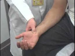 Image result for Carpal Compression Test