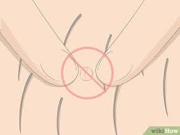 Staph infection can further accentuate other skin ailments including, boils, impetigo, food poisoning, cellulitis, and toxic shock syndrome. How To Get Rid Of Ingrown Pubic Hair With Pictures Wikihow
