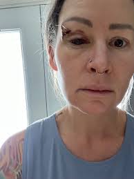 Testimony of Healing from Car Accident and Mini-Stroke