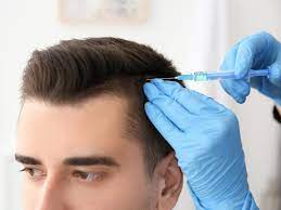 Treatments for male pattern hair loss and female pattern hair loss may include: Topical Hair Loss Treatments Market Increasing Demand With Leading Key Players Cipla Marico Vitabiotics Alpecin Medgadget