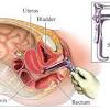 Selalunya doktor hanya akan masukkan kita ke dalam bilik bersalin bila bukaan rahim mencapai 6cm. 1