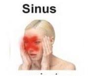 صداع الجيوب الانفية Historical Figures Historical Sinusitis